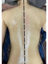 ムルニ ハティ(Murni hati)/【施術風景】全身スリミング