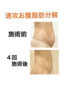 鍼灸サロンオランジュ 高槻富田院/
