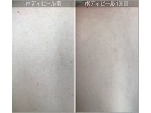 アイアール(ir)/