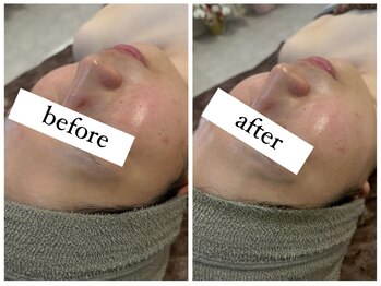 シエル(CieL)/花粉によるダメージにも◎