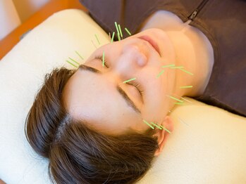 むろたはり きゅう院/【施術風景】美容鍼