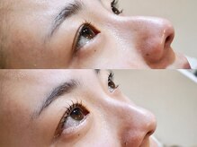 アオ 渋谷(ao.)/ケラチンラッシュリフト