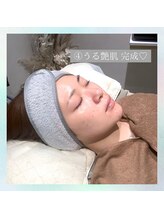 ラヴィン なんばスカイオ店(Lovin)/【ハーブピーリング施術行程】