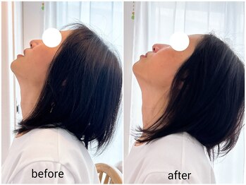 グリッタープラス(glitter plus)/1回でこの変化!