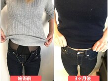 こんだ整骨院の雰囲気（3ヶ月後！ダイエットならお任せ下さい！）