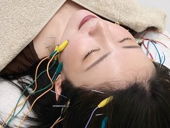 グリーン 京都店(green)の写真/Reスタートキャンペーン♪【シンプル美容鍼60分¥3650】内側からたるみケア&お肌の調子UP◎口コミでも話題★