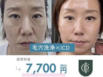 ラヴィ(Ravi)/ICDスキンケア