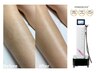 足の印象が変わる見せたくなる脚へひざ下集中ケア【ひざ下脱毛体験】