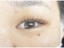 ベリーナ(Bellina)/