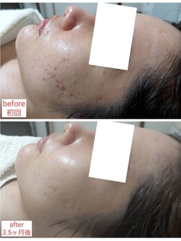 ミュー(Mieux)/勇気を出して来て良かった！