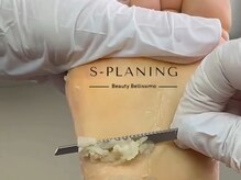 ビューティーベリッシモ(Beauty Bellissimo)の雰囲気（《足裏お悩み解決》本格足裏角質ケア/靴タコ/魚の目/乾燥ひび割）