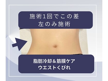 クールヴィラ(Cool Villa)の写真