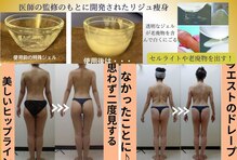 ジョイア 本店(Beauty&Detox gioia)