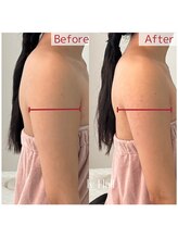 ルルアス(LuLu AS)/