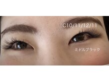 ゆくいの雰囲気（奥二重さんでも左右差の違いにお悩みの方でもご相談下さい♪）