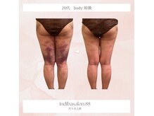 エイティーエイト(88)の雰囲気(術後回復をすばやくサポートし綺麗を早く届ける駆け込み寺へ◎)