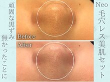 ネオファースト(NeoFirst)/透明感と艶感アップ★