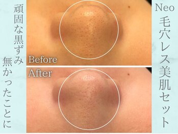 ネオファースト(NeoFirst)/透明感と艶感アップ★