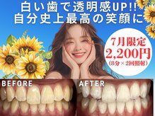 LBSホワイトニング 新宿店
