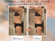 シェルシア(Cielcia)/筋膜リンパ痩身で姿勢改善！