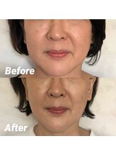 ロウエン(LAUEN)/