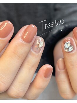 トゥリートップ(Treetop)/