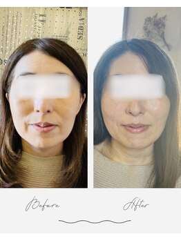 ナギスポット(Nagispot)/