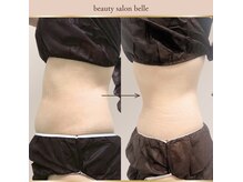 ベル(belle)/ウエストbefore after