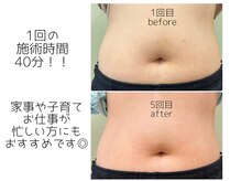 ほねつぎ一休さん 宇品店の雰囲気（最新機器でダイエットから体の不調まで解消！）