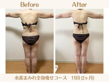 ヨサパーク ククナ 大塚(YOSA PARK kukuna)/痩身/ダイエット/よもぎ蒸し痩身