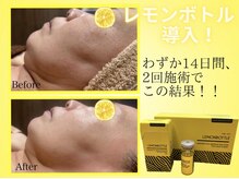 韓国発【レモンボトル】はここがスゴイ!