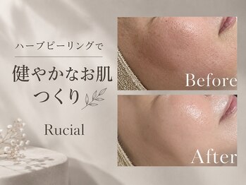 ルシアル(Rucial)の写真/［明石/魚住］白玉ワックスでちゅるちゅる水光肌へ☆大人気ハーブピーリングとのセットやブライダルにも◎