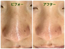 オライティックメソッド(orlytec methods)/深層覚醒ダーマスクライバー…7