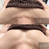 フェイスプラス(face plus)