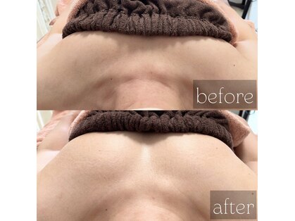 フェイスプラス(face plus)の写真