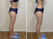 カプリス(CAPRiCE)/リンパドレナージュ