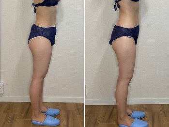 カプリス(CAPRiCE)/リンパドレナージュ