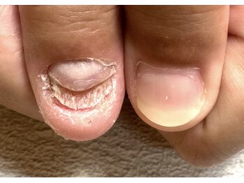 グレースレディ/しっかりカウンセリングから～