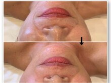 エフェクト 塚口店(effect)/Before After