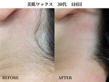 サンビ(SANBI)/産毛ケアはSANBIにお任せ！