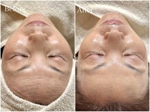 リノア(Lino'aka)/セルマントリートメント