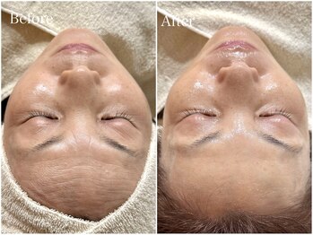 リノア(Lino'aka)/セルマントリートメント