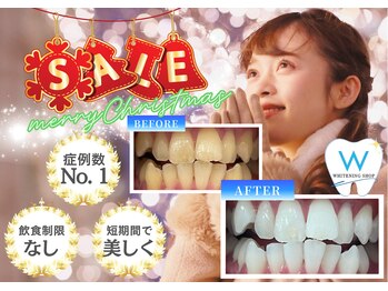 ホワイトニングショップ 高田馬場店