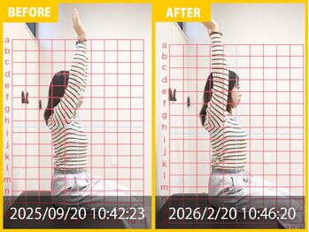 整体院 元 宇城松橋店/肩の痛みと姿勢の悪さの悩み