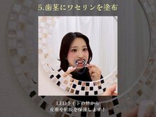 ホワイトニングサロン ホワイト 天童店(WHITE)/5.歯茎にワセリンを塗布