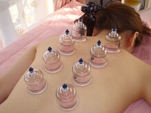 ほぐしニキュッパ(ほぐし2980)/カッピング