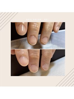 レイ(Rei)/ Before/ After