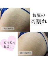 サロン ド レナ(Salon de LENA) 肌質改善は 体も可能