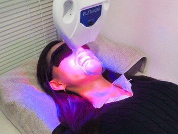 ユーラボ 表参道(YOU-LAB)/施術イメージ《ホワイトニング》