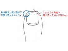 東京巻き爪センター 本院 麻布十番/正しい爪の切り方【東京】